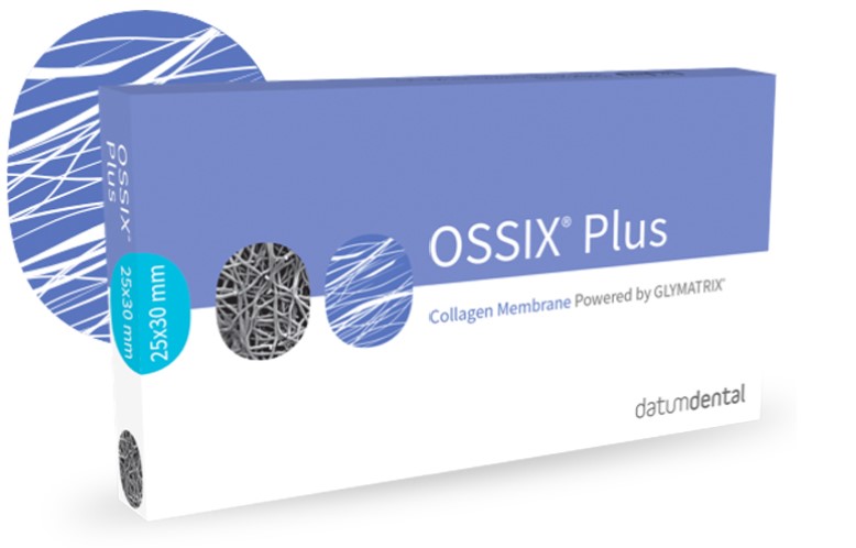 Science of Implant Surgery | All-on-4 reg , Extractions and Dentures