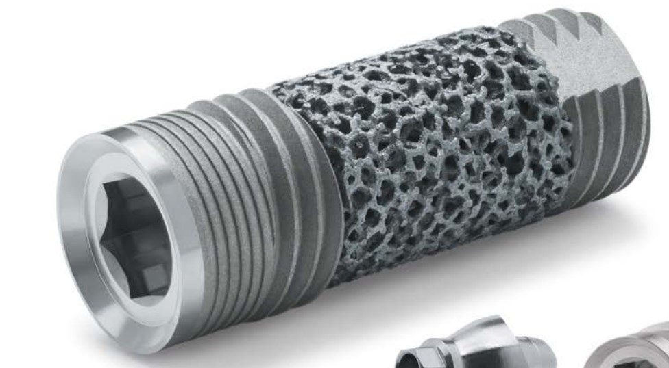 Science of Implant Surgery | Dentures, Dental Sealants and All-on-4 reg 