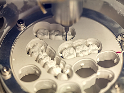 Science of Implant Surgery