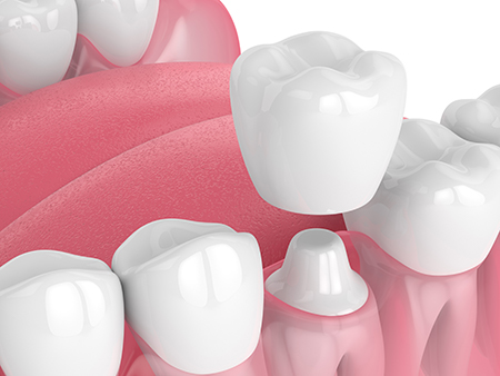 Science of Implant Surgery
