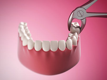 Science of Implant Surgery