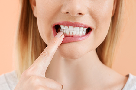 Science of Implant Surgery
