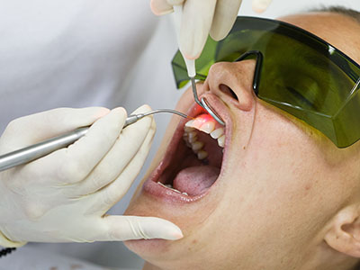Science of Implant Surgery
