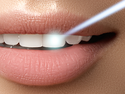 Science of Implant Surgery